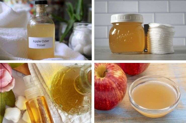 10 DIY Apple Cider Vinegar Toner Recipes That Actually Work